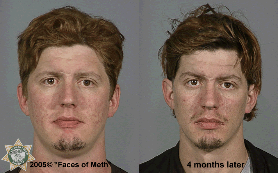 PHOTOS: Before And After Mugshots Of Meth Users | WJLA