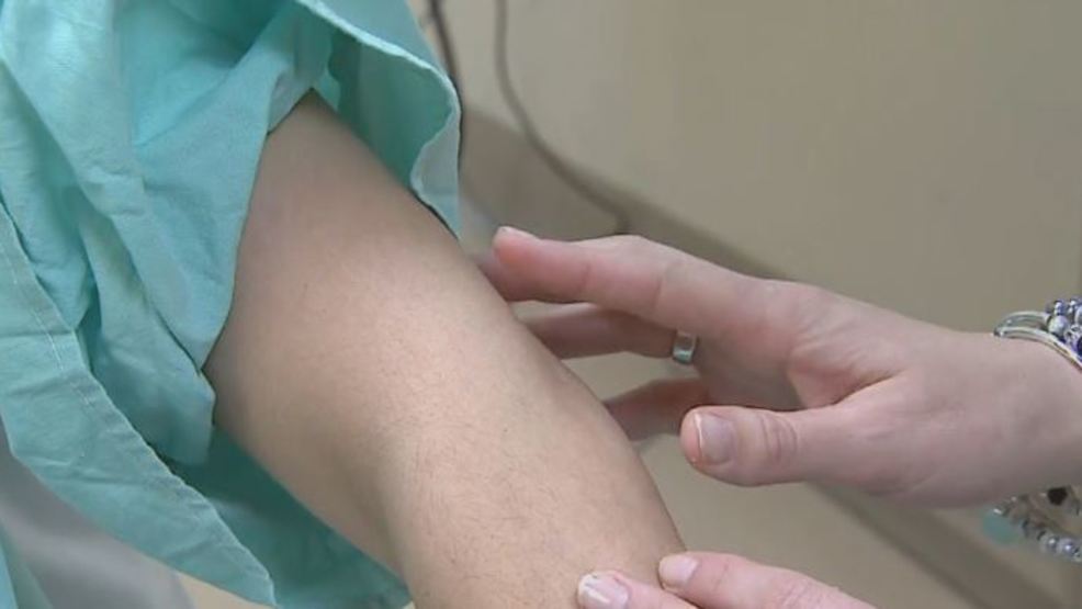 Melanoma deadliest form of cancer, now becoming more common - KGBT-TV thumbnail
