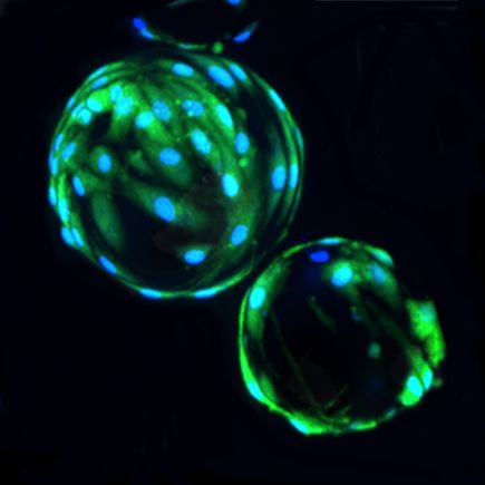 Stem Cells Show Promise For Treating >> Ohsu Stem Cell Study Shows Promise In Treating Strokes Katu Stem Cells Show Promise For Treating >> Ohsu Stem Cell Study Shows Promise In Treating Strokes Katu